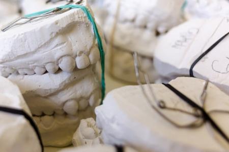 Кто из коломенцев может получить бесплатное зубопротезирование