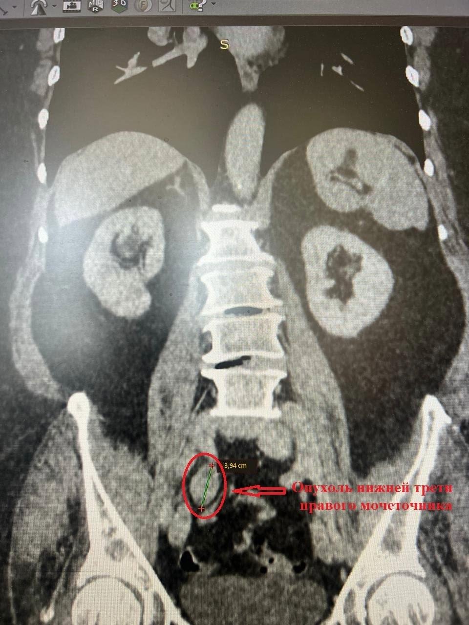 Фотография- Новости Коломны Новости Коломны- фото